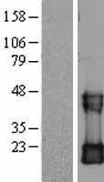CDC42 Human Over-expression Lysates NM_001791