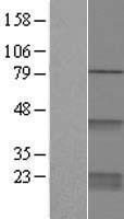 CDC42 Human Over-expression Lysates NM_044472