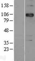 P cadherin (CDH3) Human Over-expression Lysates NM_001793