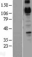 R Cadherin (CDH4) Human Over-expression Lysates NM_001794