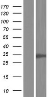 CDK2 Human Over-expression Lysates NM_052827