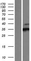 CDK3 Human Over-expression Lysates NM_001258
