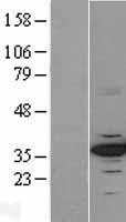 CDK4 Human Over-expression Lysates NM_000075