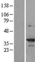 CDK6 Human Over-expression Lysates NM_001259