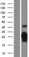 ls001027 p27 kip 1 cdkn1b human over expression lysates nm 004064 wb testing 1