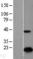 p16INK4A (CDKN2A) Human Over-expression Lysates NM_000077