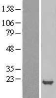 p19 INK4d (CDKN2D) Human Over-expression Lysates NM_079421