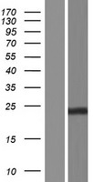 CDKN3 Human Over-expression Lysates NM_001130851
