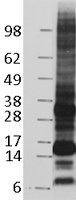 CD52 Human Over-expression Lysates NM_001803