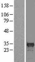 CDX1 Human Over-expression Lysates NM_001804