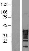 CDX2 Human Over-expression Lysates NM_001265