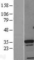 CDX4 Human Over-expression Lysates NM_005193