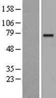 Calmegin (CLGN) Human Over-expression Lysates NM_004362