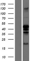 CEBP Alpha (CEBPA) Human Over-expression Lysates NM_004364