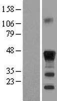 CEBP Beta (CEBPB) Human Over-expression Lysates NM_005194
