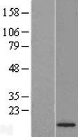 CENPA Human Over-expression Lysates NM_001042426