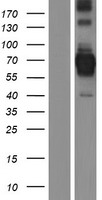 CENPB Human Over-expression Lysates NM_001810