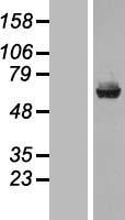 Liver Carboxylesterase 1 (CES1) Human Over-expression Lysates NM_001025194