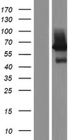 Liver Carboxylesterase 1 (CES1) Human Over-expression Lysates NM_001025195