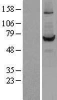 Liver Carboxylesterase 1 (CES1) Human Over-expression Lysates NM_001266