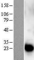 Centrin 1 (CETN1) Human Over-expression Lysates NM_004066