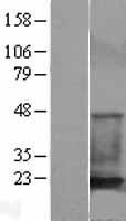 Cofilin 1 (CFL1) Human Over-expression Lysates NM_005507