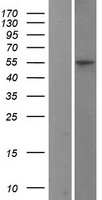 DPP1 (CTSC) Human Over-expression Lysates NM_001814