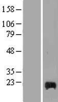 DPP1 (CTSC) Human Over-expression Lysates NM_148170