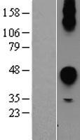 CEACAM7 Human Over-expression Lysates NM_006890