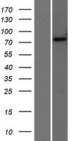 Choline Acetyltransferase (CHAT) Human Over-expression Lysates NM_020549