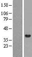AKR1C4 Human Over-expression Lysates NM_001818