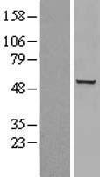 Chk1 (CHEK1) Human Over-expression Lysates NM_001114121