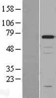 Chromogranin A (CHGA) Human Over-expression Lysates NM_001275