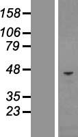 CHI3L1 Human Over-expression Lysates NM_001276