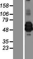CHI3L2 Human Over-expression Lysates NM_001025197