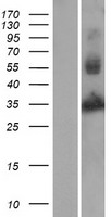 CHI3L2 Human Over-expression Lysates NM_001025199