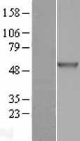 CHIT1 Human Over-expression Lysates NM_003465