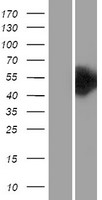 Choline kinase alpha (CHKA) Human Over-expression Lysates NM_001277