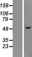 Choline kinase alpha (CHKA) Human Over-expression Lysates NM_212469