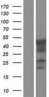 CHKL (CHKB) Human Over-expression Lysates NM_005198