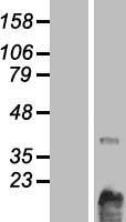 CHKL (CHKB) Human Over-expression Lysates NM_152253