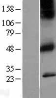 CHRM1 Human Over-expression Lysates NM_000738
