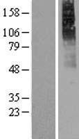 ls001129 chrm2 human over expression lysates nm 001006630 wb testing 1
