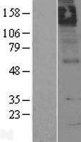 Muscarinic Acetylcholine Receptor M5 (CHRM5) Human Over-expression Lysates NM_012125