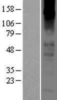 ls001135 chrna2 human over expression lysates nm 000742 wb testing 1