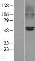 Nicotinic Acetylcholine Receptor beta 2 (CHRNB2) Human Over-expression Lysates NM_000748