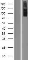 IKK alpha (CHUK) Human Over-expression Lysates NM_001278