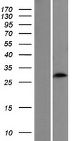 CIDE A (CIDEA) Human Over-expression Lysates NM_198289