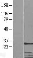 CKAP1 (TBCB) Human Over-expression Lysates NM_001281