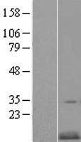 CKS2 Human Over-expression Lysates NM_001827